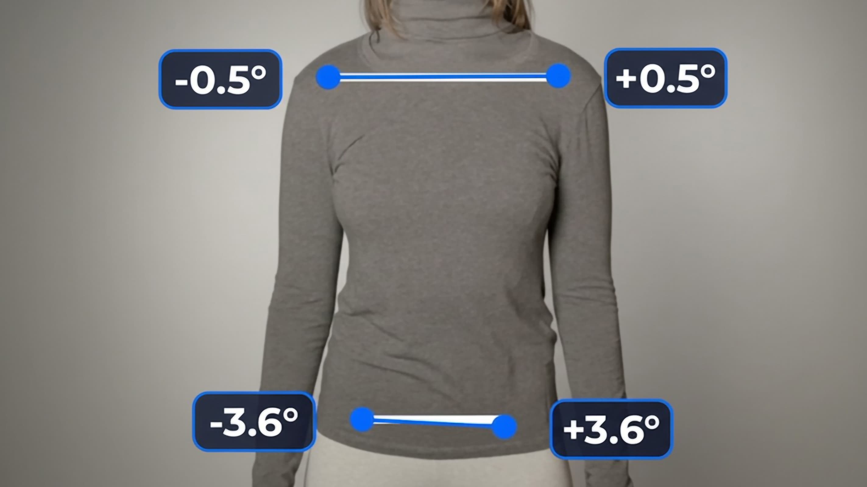 Computer vision posture analysis measuring shoulder alignment from a front-facing patient image.